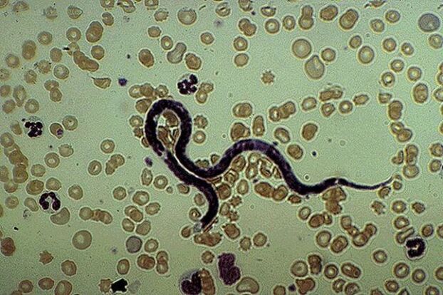 subcutaneous parasite filariasis