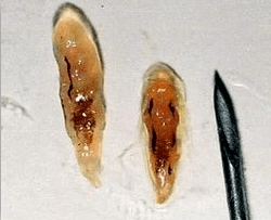 Opistarchi