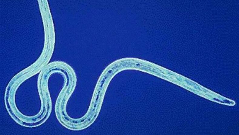 Filaria