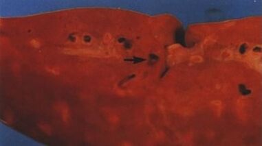 which parasites can live in the human liver