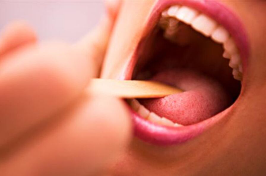 species of parasites in the human mouth